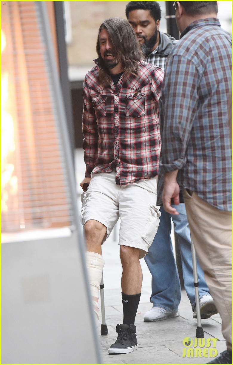Dave Grohl Heads Out For the First Time Post Leg Operation Photo